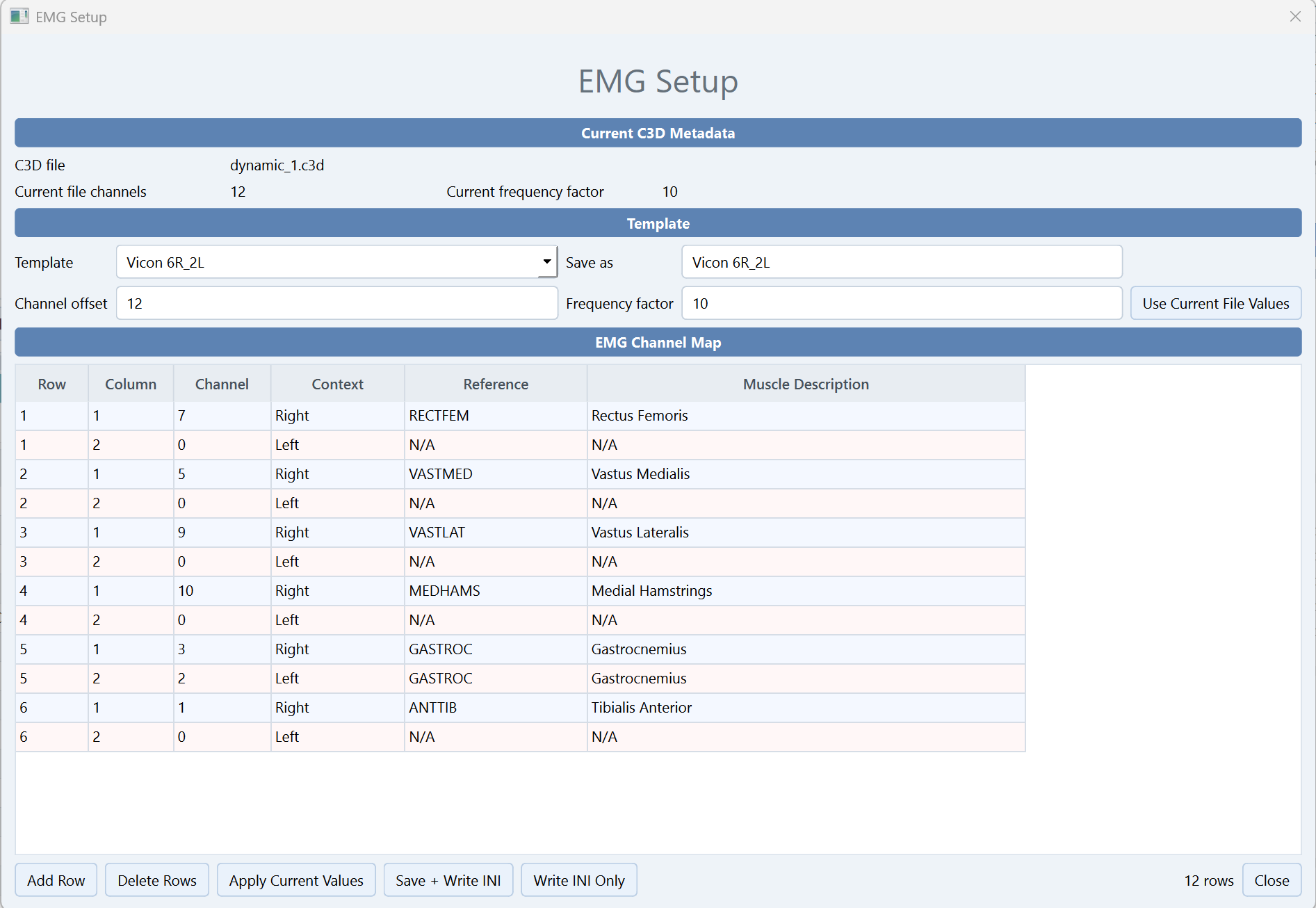 CGAS Qt Manager EMG Setup screen